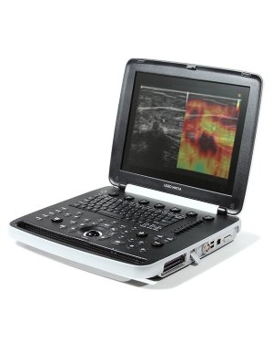 Ультразвуковой сканер Samsung UGEO HM70A